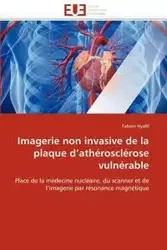 Imagerie non invasive de la plaque d''athérosclérose vulnérable - HYAFIL-F