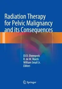 Radiation Therapy for Pelvic Malignancy and its Consequences - Ehrenpreis Eli Daniel