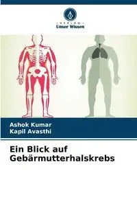 Ein Blick auf Gebärmutterhalskrebs - Kumar Ashok