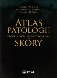 Atlas patologii złośliwych nowotworów skóry - Leszek Woźniak, Krzysztof W. Zieliński, Andrzej K