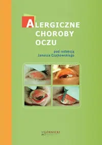 Alergiczne choroby oczu - red. Janusz Czajkowski