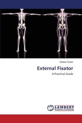 External Fixator - Parker Shaker