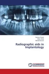 Radiographic aids in Implantology - Chand Keshav
