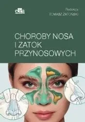 Choroby nosa i zatok przynosowych - Tomasz Zatoński