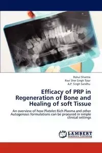 Efficacy of Prp in Regeneration of Bone and Healing of Soft Tissue - Sharma Rahul