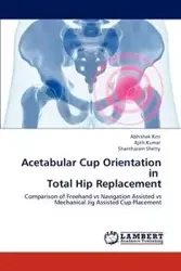 Acetabular Cup Orientation in Total Hip Replacement - Kini Abhishek