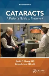 Cataracts - Chang David F.