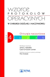 Wzorce protokołów operacyjnych w chirurgii.. T.4 - Jamal Hoballah