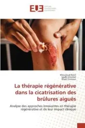La thérapie régénérative dans la cicatrisation des brûlures aiguës - Rmili Khouloud