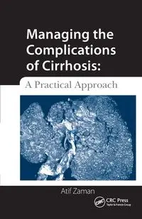 Managing the Complications of Cirrhosis - Zaman Atif