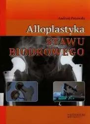 Alloplastyka stawu biodrowego - Andrzej Pozowski