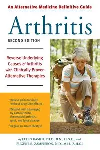 An Alternative Medicine Guide to Arthritis - Ellen Kamhi