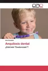 Anquilosis dental - Ana González