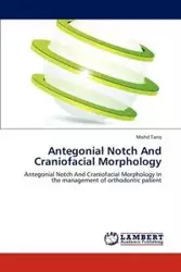 Antegonial Notch And Craniofacial Morphology - Tariq Mohd