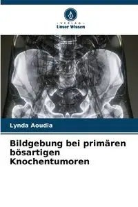 Bildgebung bei primären bösartigen Knochentumoren - Lynda Aoudia