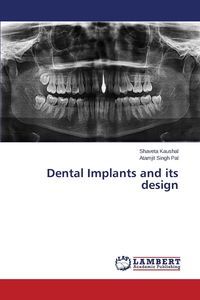 Dental Implants and Its Design - Kaushal Shaveta