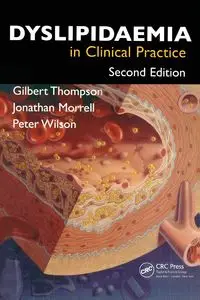 Dyslipidaemia in Clinical Practice - Gilbert Thompson