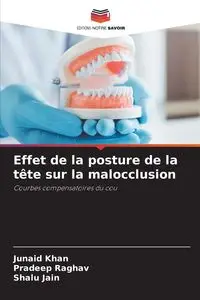 Effet de la posture de la tête sur la malocclusion - Khan Junaid