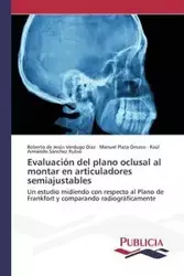 Evaluación del plano oclusal al montar en articuladores semiajustables - Roberto Verdugo Díaz de Jesús