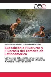 Exposición a Fluoruros y Fluorosis del Esmalte en Latinoamérica - González-Martínez Farith