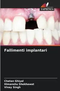 Fallimenti implantari - Ghiyal Chetan