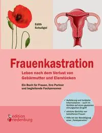 Frauenkastration - Leben nach dem Verlust von Gebärmutter und Eierstöcken - Edith Schuligoi