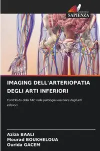 IMAGING DELL'ARTERIOPATIA DEGLI ARTI INFERIORI - BAALI Aziza