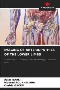 IMAGING OF ARTERIOPATHIES OF THE LOWER LIMBS - BAALI Aziza