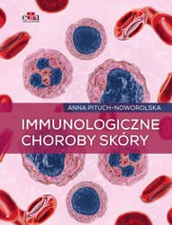 Immunologiczne choroby skóry - Pituch-Noworolska A.