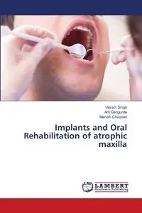 Implants and Oral Rehabilitation of atrophic maxilla - Singh Vikram