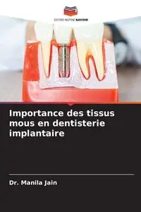 Importance des tissus mous en dentisterie implantaire - Jain Dr. Manila