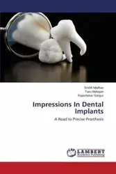 Impressions In Dental Implants - Madhav Srishti