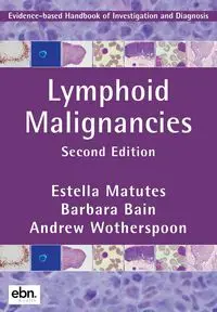 Lymphoid Malignancies - Estella Matutes