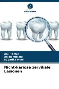 Nicht-kariöse zervikale Läsionen - Tomer Anil