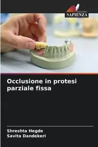 Occlusione in protesi parziale fissa - Hegde Shreshta