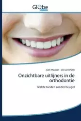 Onzichtbare uitlijners in de orthodontie - Madaan Jyoti