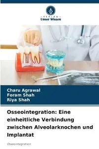 Osseointegration - Agrawal Charu