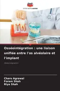 Osséointégration - Agrawal Charu