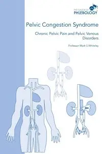 Pelvic Congestion Syndrome - Chronic Pelvic Pain and Pelvic Venous Disorders - Mark Whiteley S