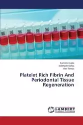 Platelet Rich Fibrin And Periodontal Tissue Regeneration - Gupta Kanishk