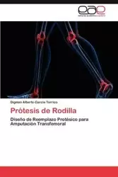Protesis de Rodilla - Alberto Garcia Torrico Digman