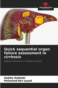 Quick sequential organ failure assessment in cirrhosis - Debbabi Habiba