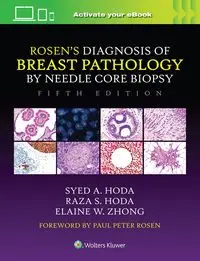 Rosen's Diagnosis of Breast Pathology by Needle Core Biopsy - Hoda Syed A, Hoda Raza S., Elaine Zhong