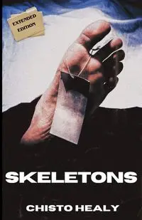 Skeletons - Healy Chisto