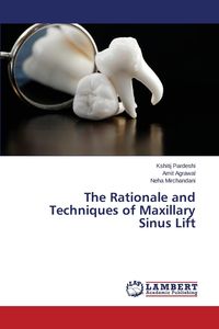 The Rationale and Techniques of Maxillary Sinus Lift - Pardeshi Kshitij