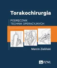 Torakochirurgia - Marcin Zieliński