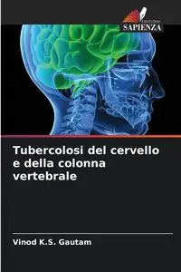 Tubercolosi del cervello e della colonna vertebrale - Gautam Vinod K.S.