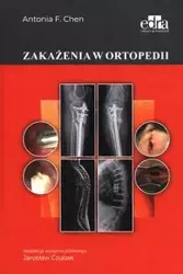Zakażenia w ortopedii - Chen A.F.