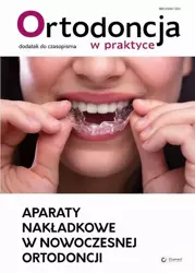 eBook Aparaty nakładkowe w nowoczesnej ortodoncji - Praca zbiorowa