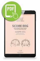 eBook SCORE EEG Standardized Computer-based Organized Reporting of EEG. CUSPE EEG Cyfrowy Ujednolicony System Prezentowania EEG - Magdalena Bosak